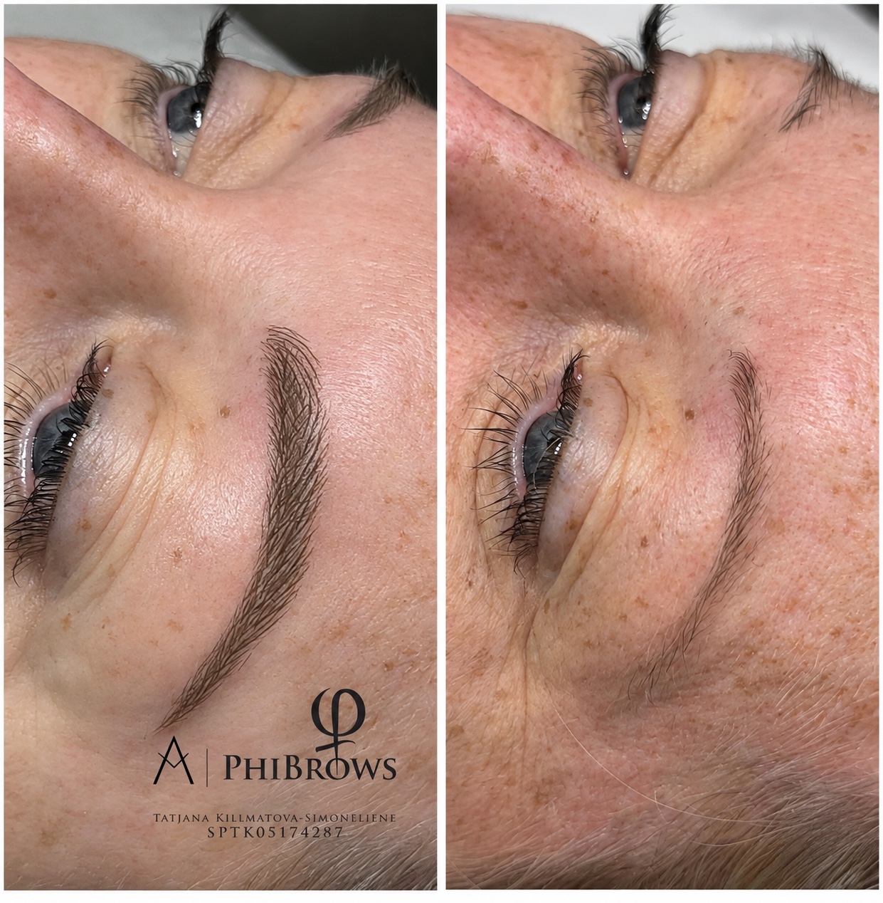 Brow treatment result
